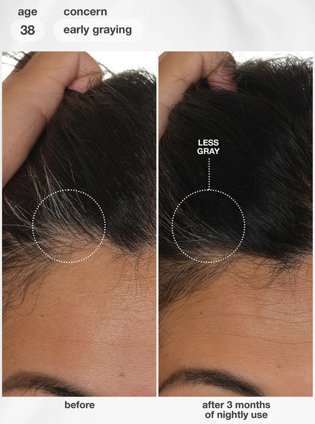 FutureIQ™ Biomimetic Hair Longevity Serum - 90ML