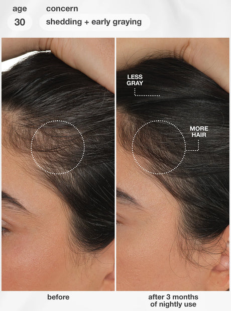 FutureIQ™ Biomimetic Hair Longevity Serum - 90ML