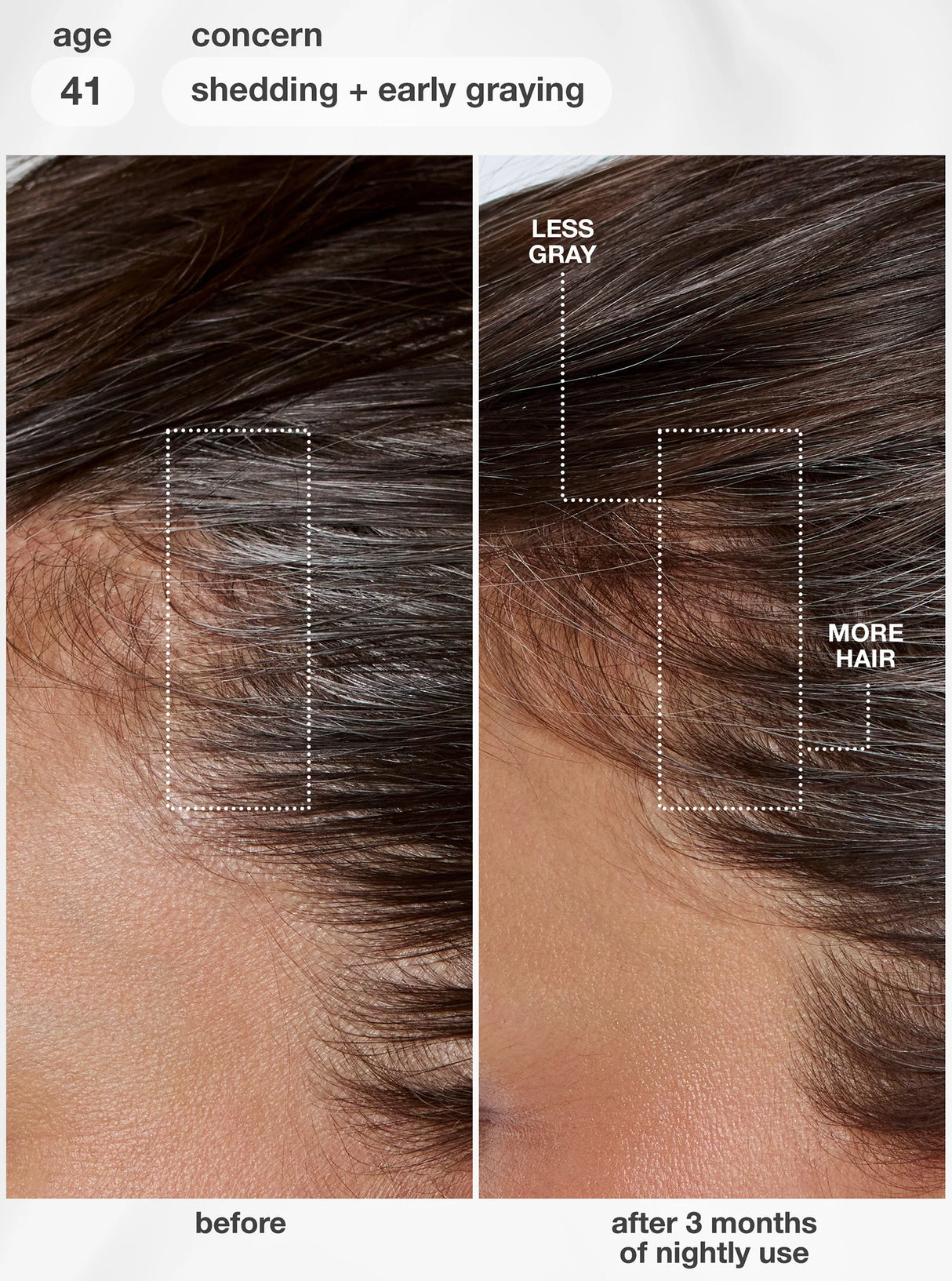 FutureIQ™ Biomimetic Hair Longevity Serum - 90ML