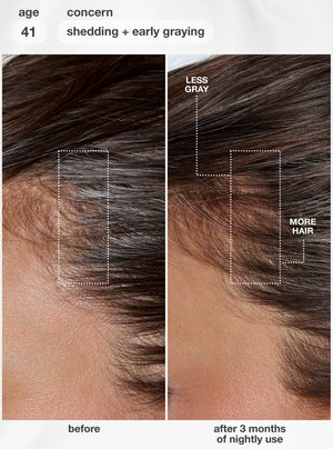 FutureIQ™ Biomimetic Hair Longevity Serum - 90ML