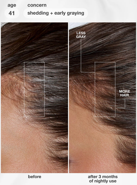 FutureIQ™ Biomimetic Hair Longevity Serum - 90ML