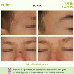 Centella Calming AC Spot Cream - (20ml)