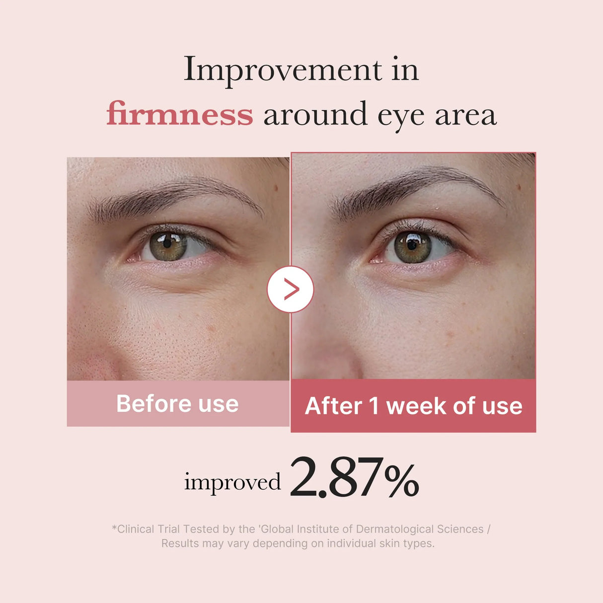 PDRN Pink Peptide Eye Cream