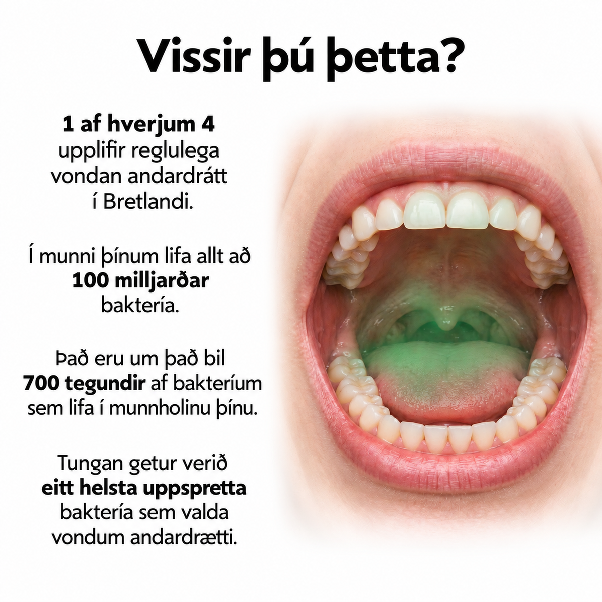 Whites Probiotic Mouth Spray – Munnsprey með góðgerlum 20 ml