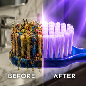 Whites UV Toothbrush Steriliser – UV sótthreinsitæki fyrir tannbursta